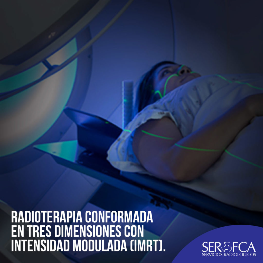 Radioterapia Conformada En Tres Dimensiones Con Intensidad Modulada Imrt Serofca 1421